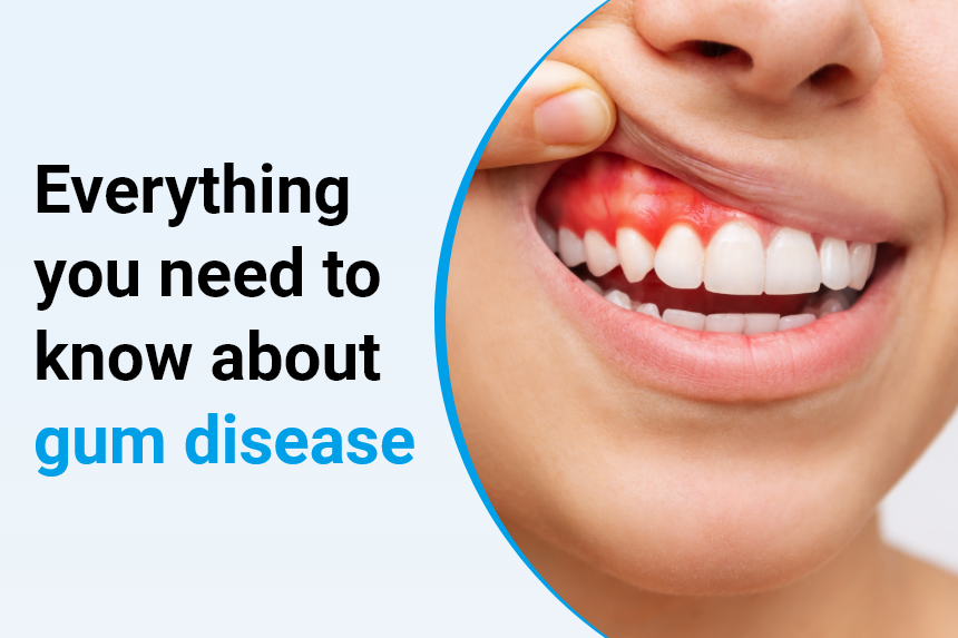 Understanding Gum Disease: What You Need to Know
